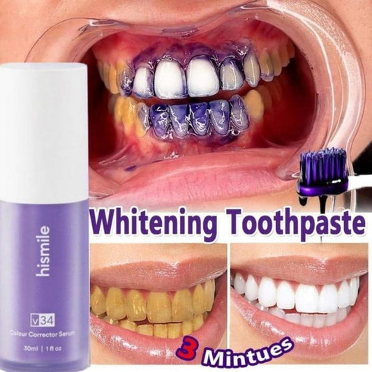 Teeth Brightening Hismiles V34 Colour