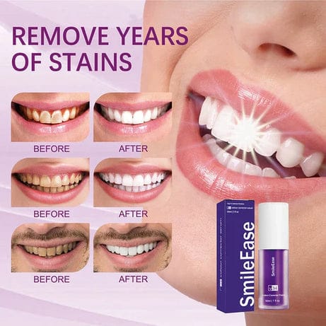 Teeth Brightening Hismiles V34 Colour